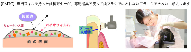 PMTCの図